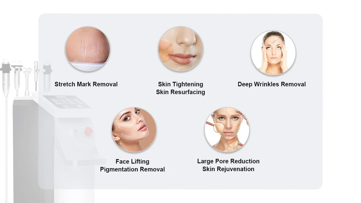 Microneedle RF